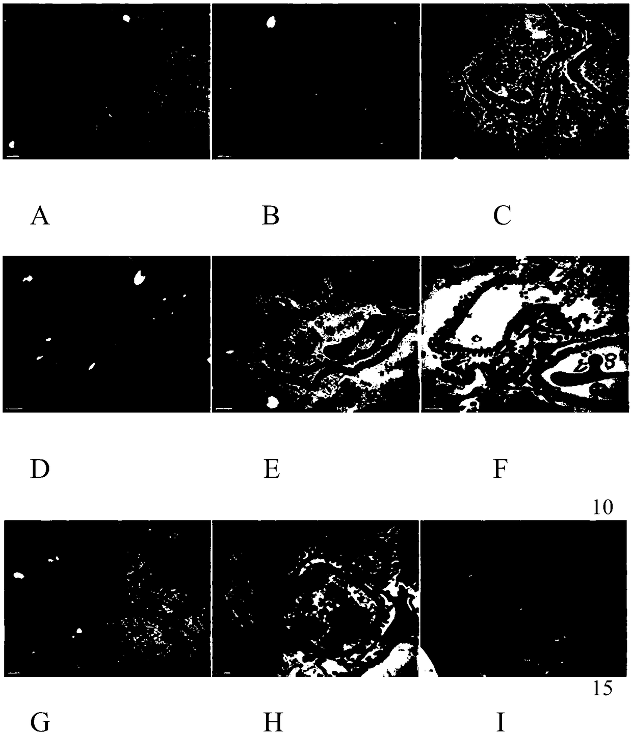 Application of emodin and combination of emodin and polydatin in treating metabolic syndrome