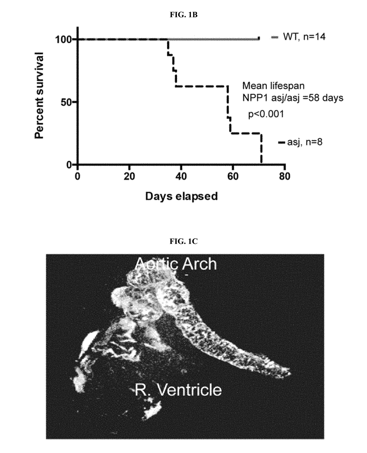 Compositions for Treating Pathological Calcification Conditions, and Methods Using Same