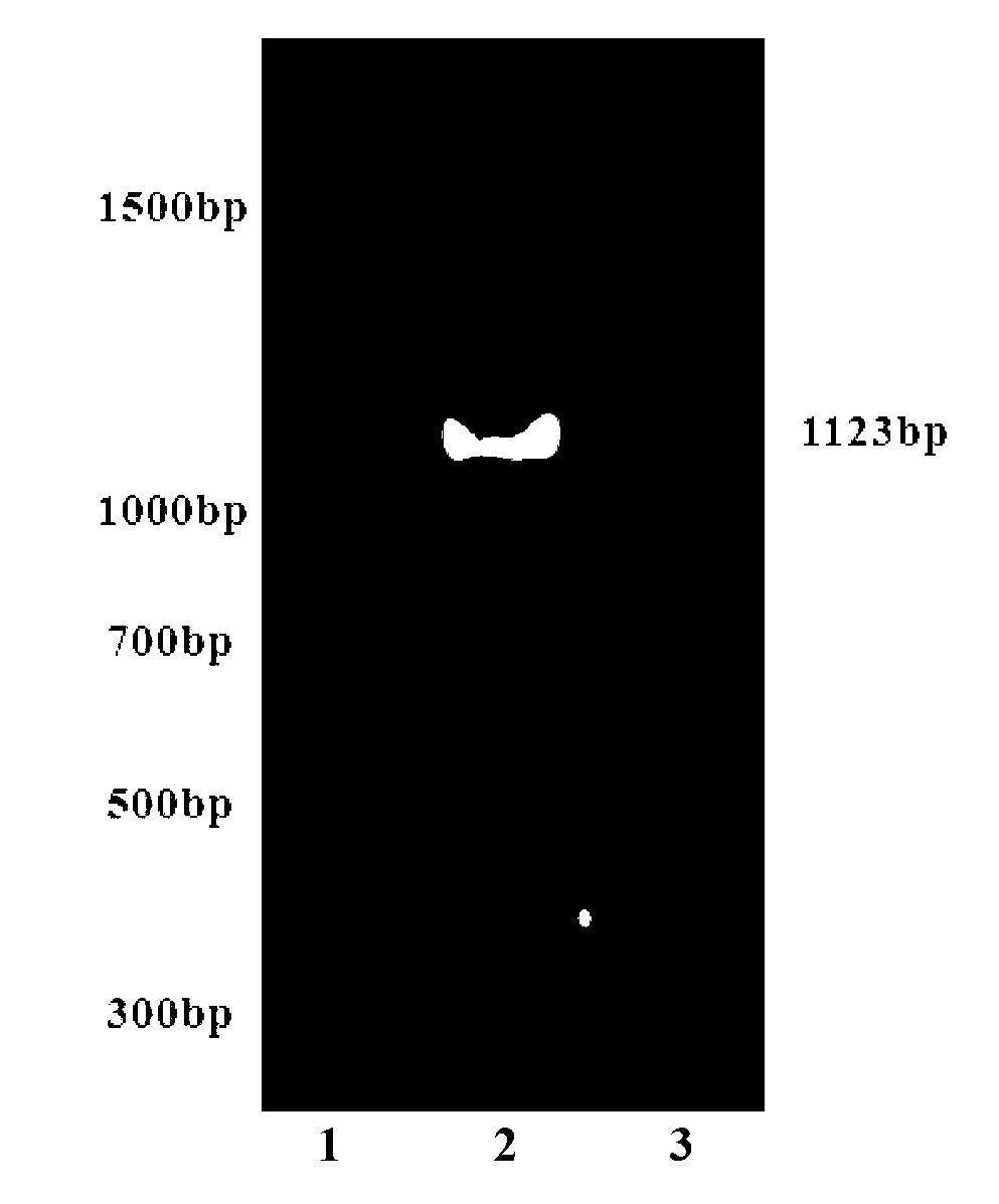 Preparation method of human protein lysine methyltransferase SET9 fusion protein