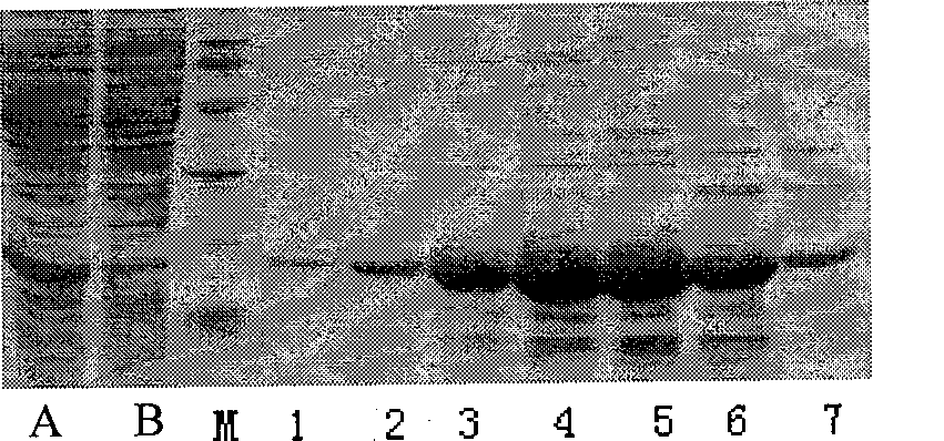 Method for preparing N-terminated acetylated thymosin alpha 1 and special engineering bacteria therefor