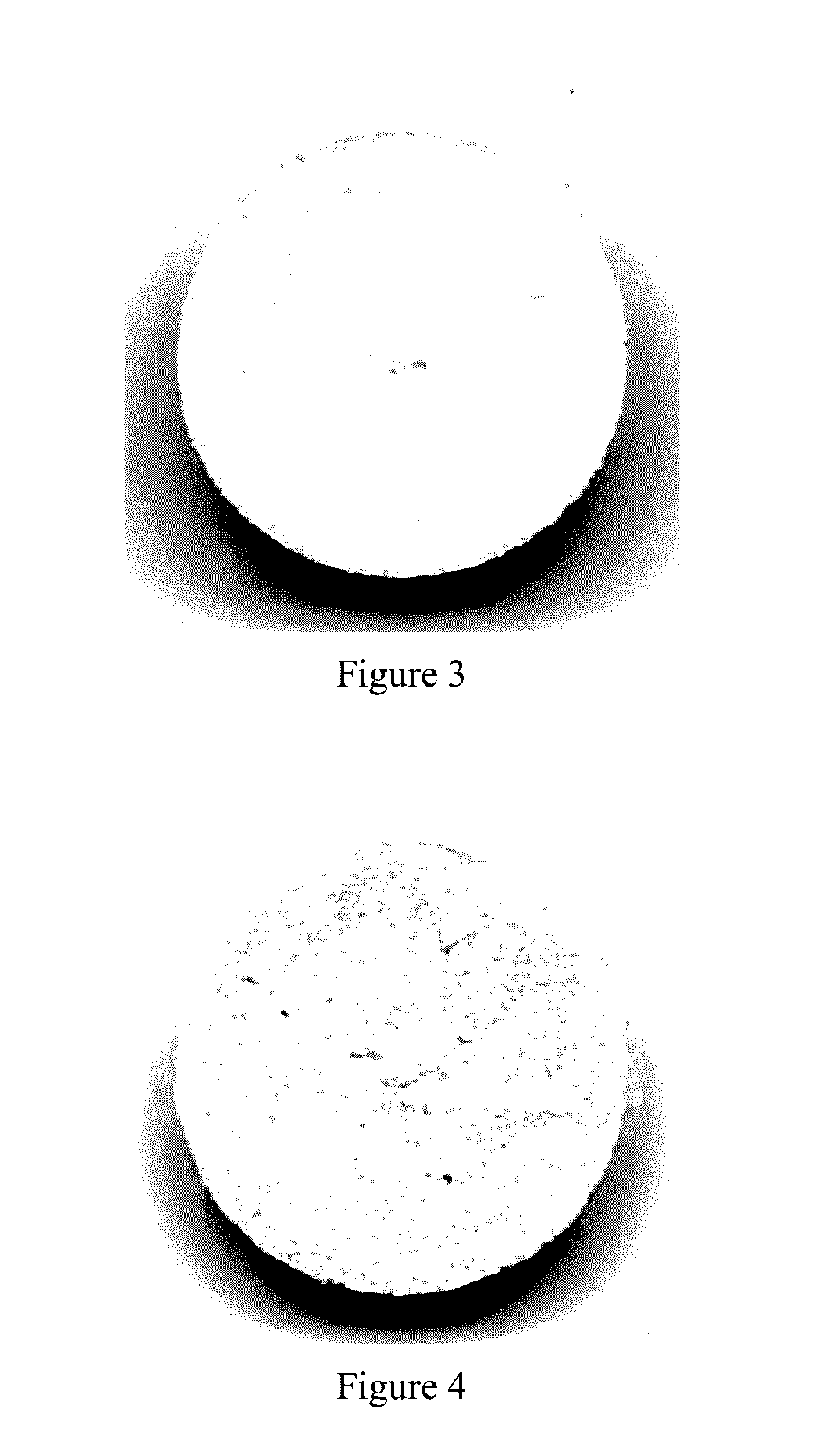 Mineralized collagen composite bone cementing and filling material