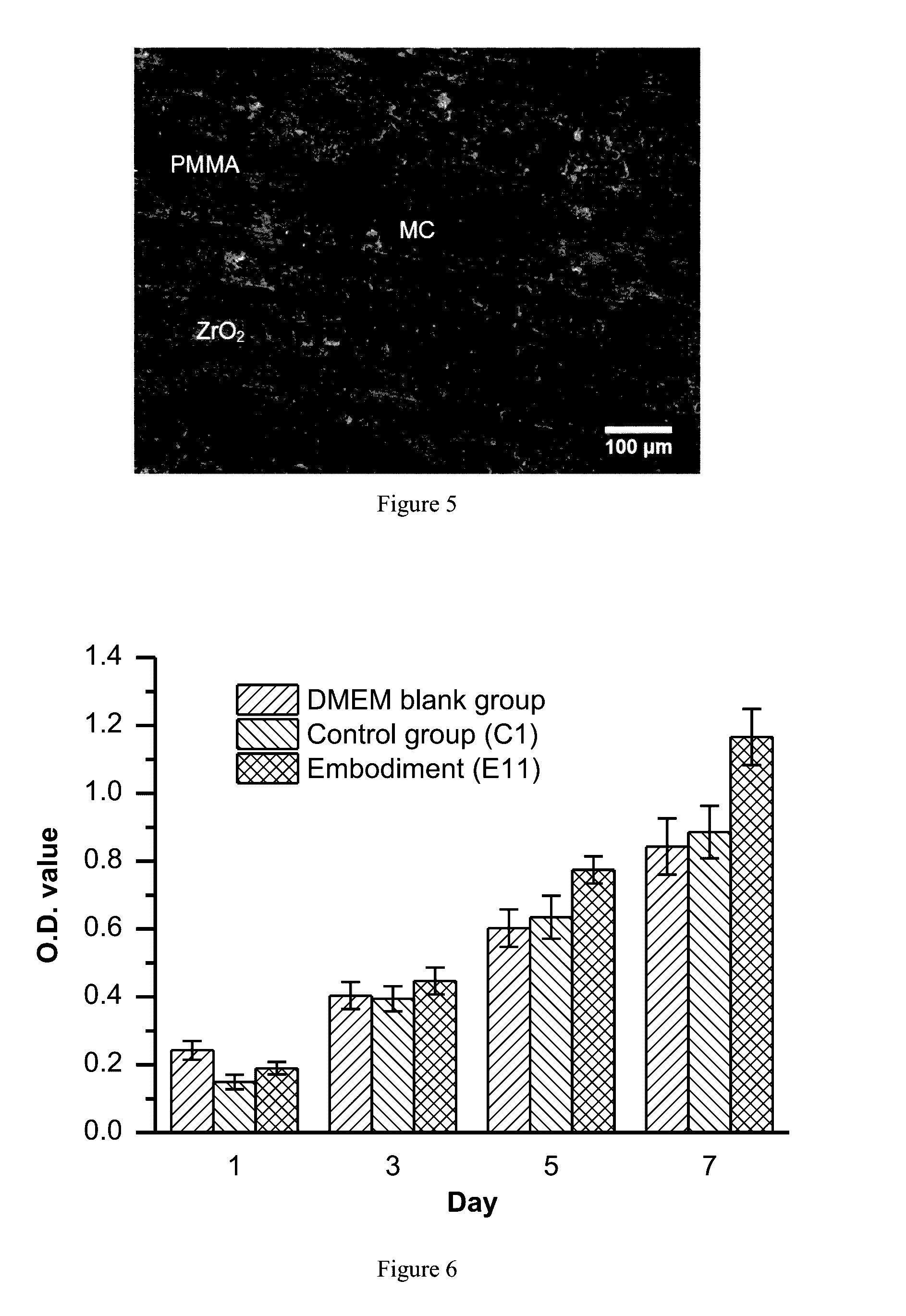 Mineralized collagen composite bone cementing and filling material