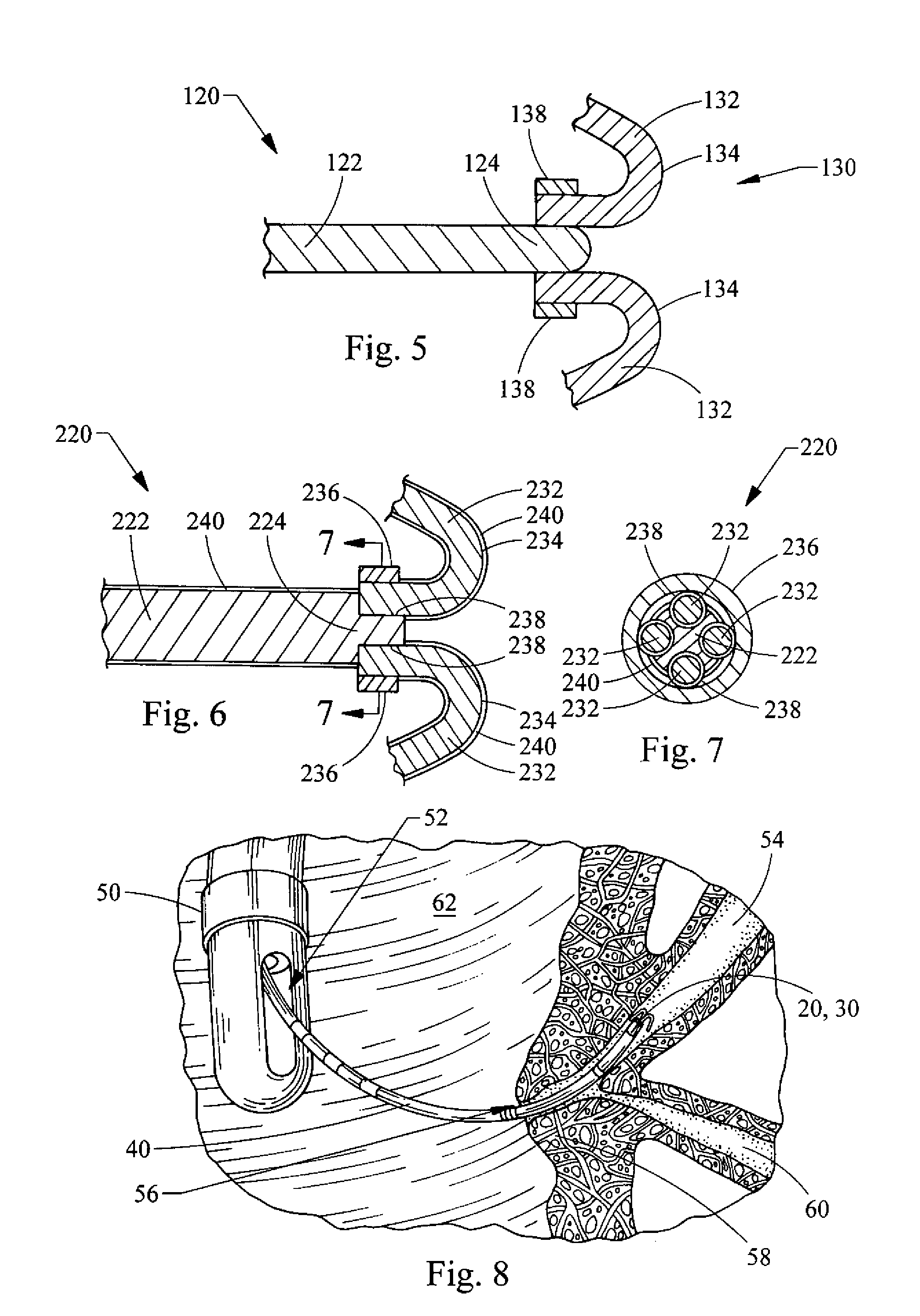 Tassel tip wire guide