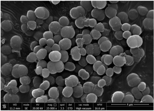 Microbial repair solution and application method thereof in slope protection of sandy foundation pit