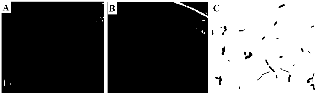 Lactobacillus reuteri HI120 of high-expression LAI (linoleic acid isomerase) and application of lactobacillus reuteri HI120