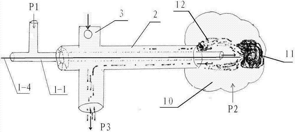 Transurethral ureter hard convection negative-pressure channel broken stone remover