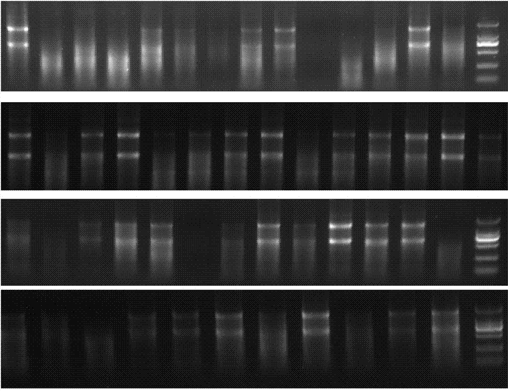 Application of miRNA marker in preparation of cervical intraepithelial neoplasia agent for screening folic acid deficiency populations