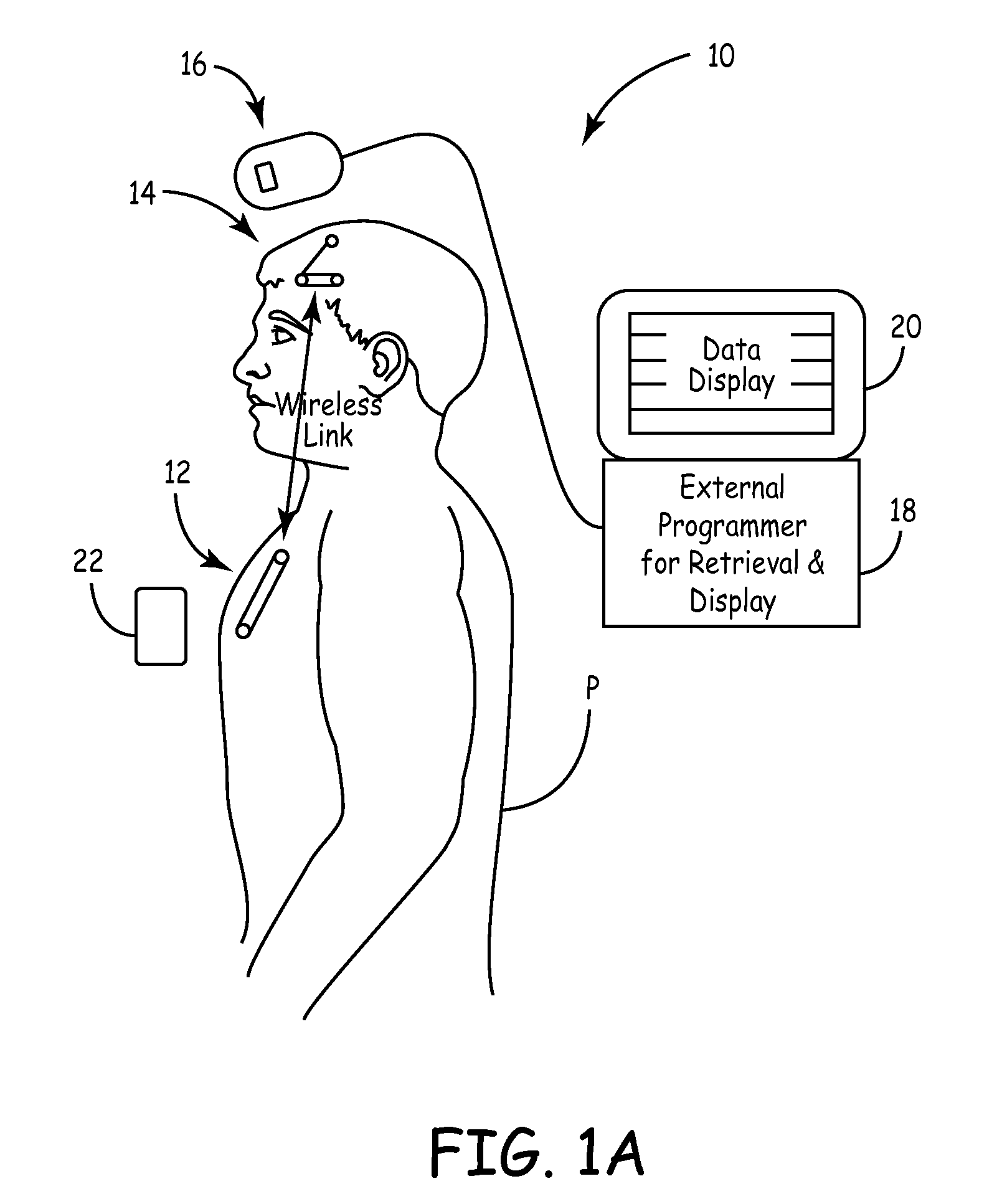 Telemetry-synchronized physiological monitoring and therapy delivery systems