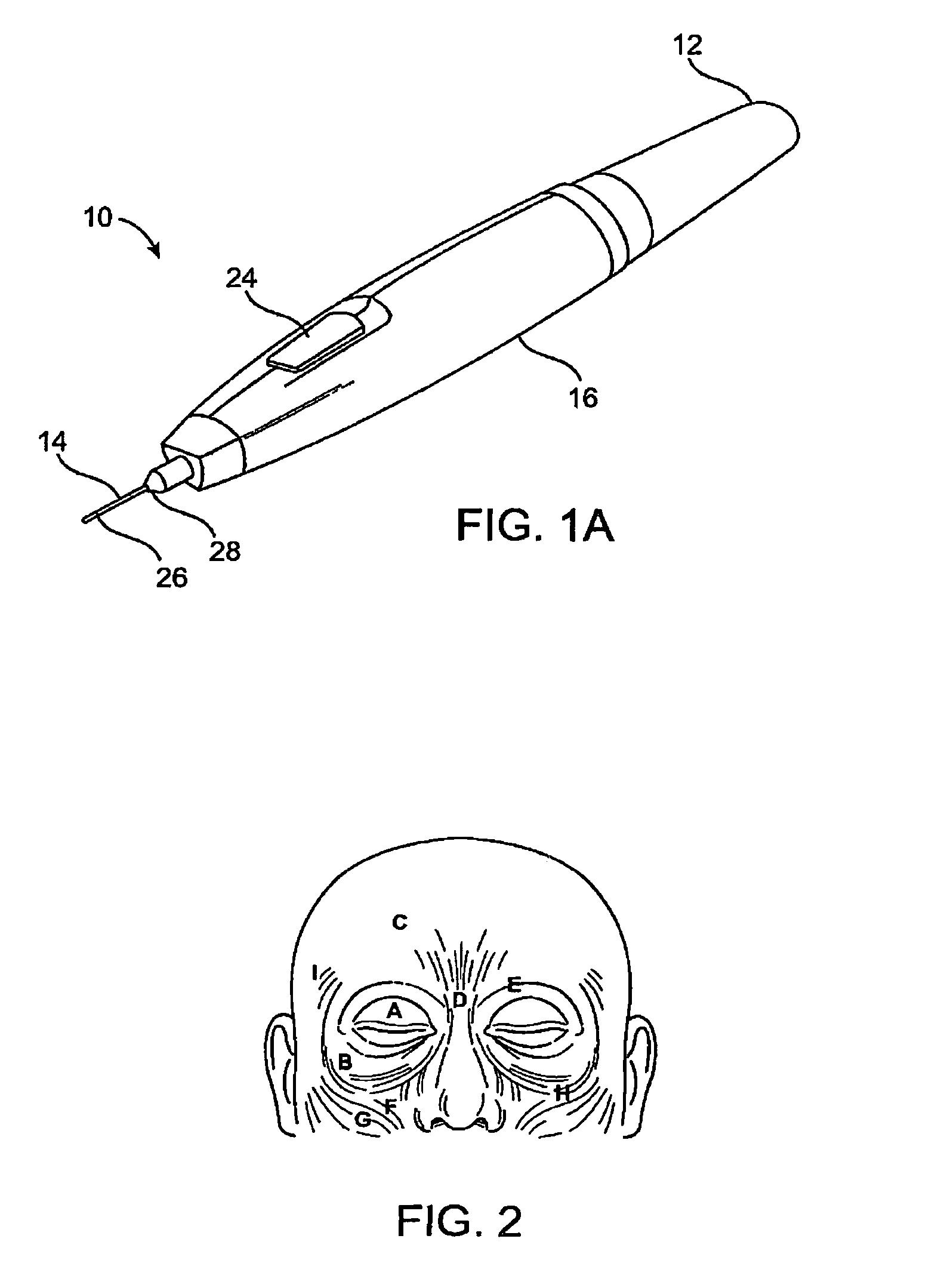 Subdermal cryogenic remodeling of muscles, nerves, connective tissue, and/or adipose tissue (fat)