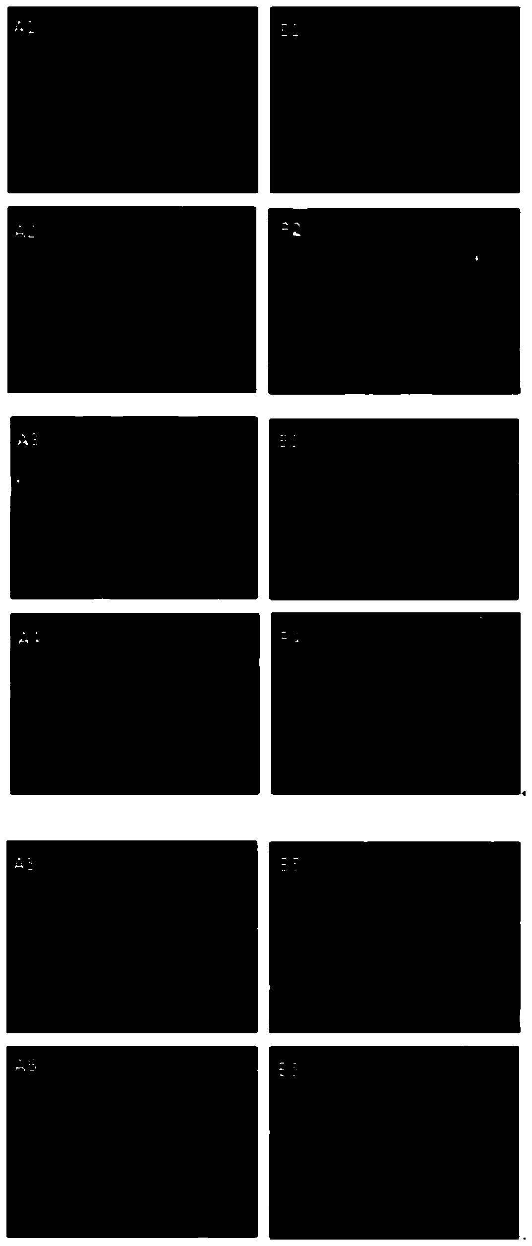 A kind of preparation method of the fish probe of egfr gene