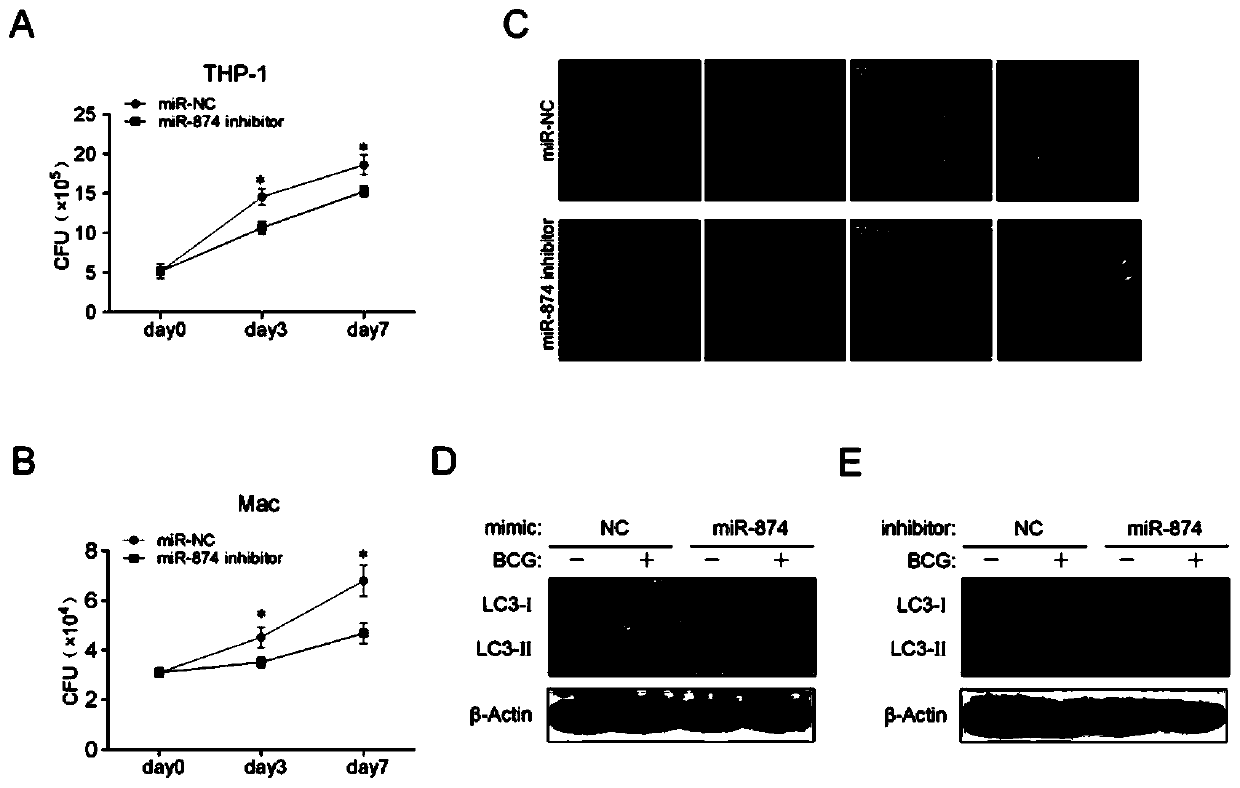 Application of peripheral blood mononuclear cells hsa-miR-8774-3p as marker of active tuberculosis