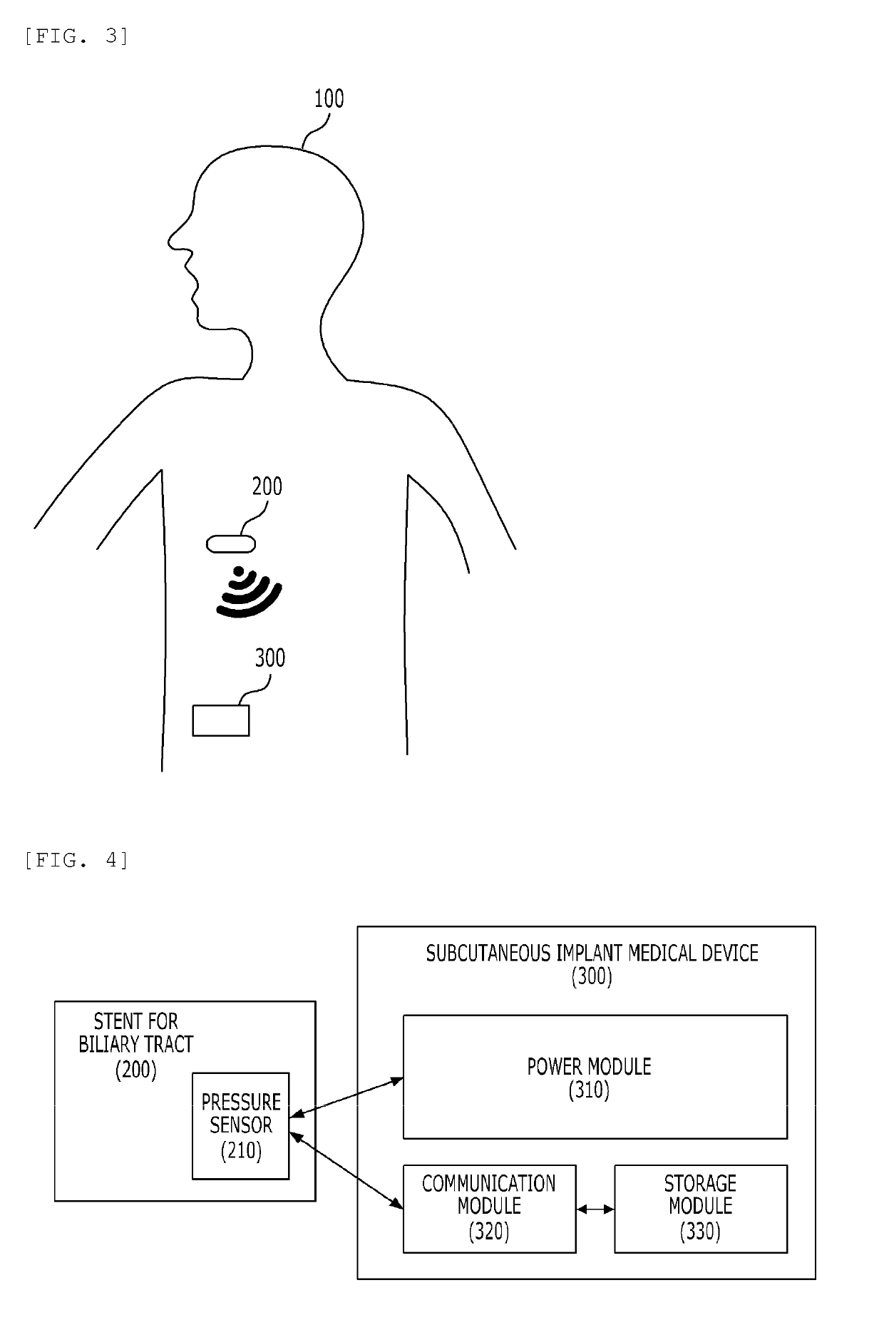 System and method for monitoring biliary obstruction