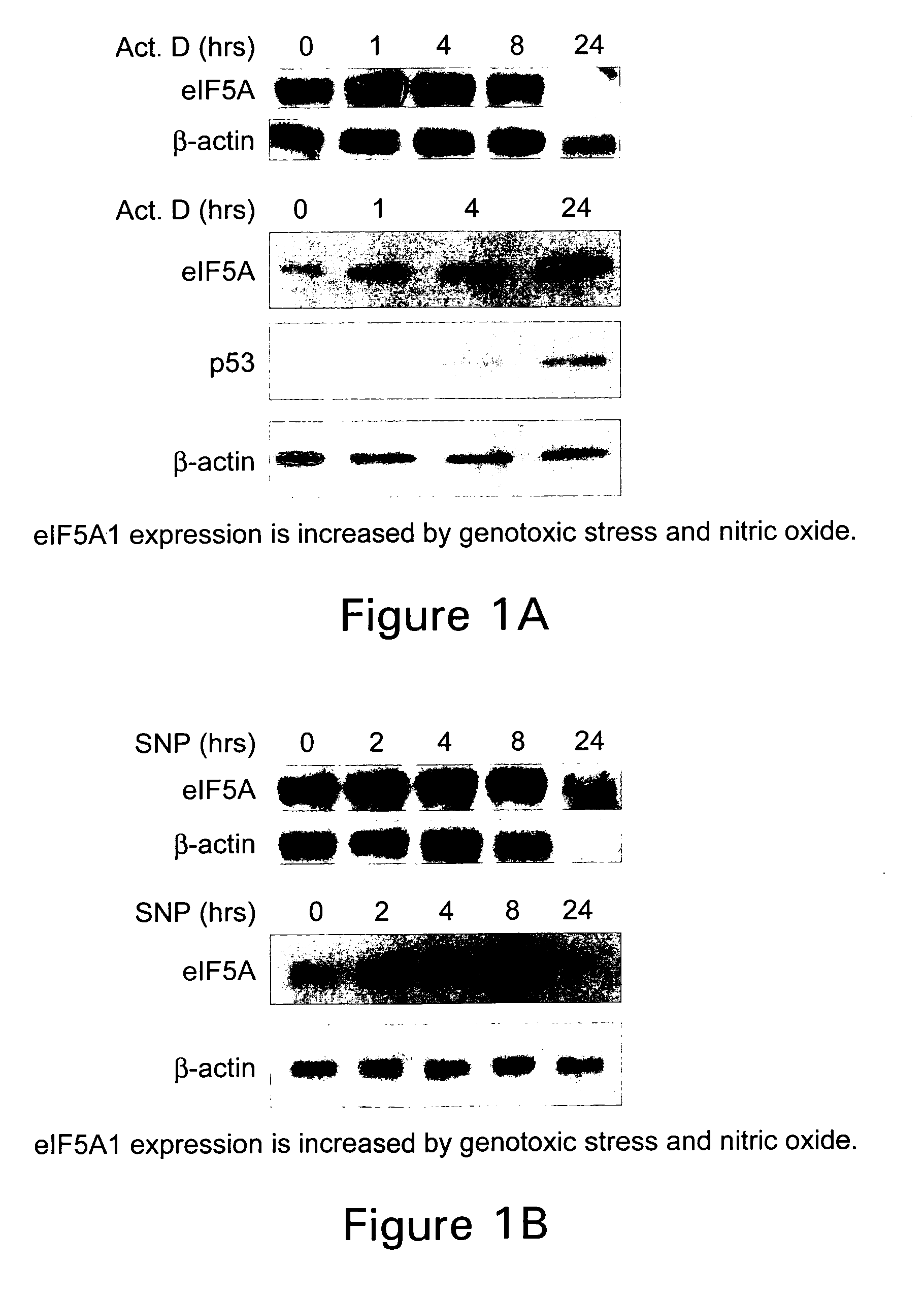 Use of eIF-5A to kill multiple myeloma cells