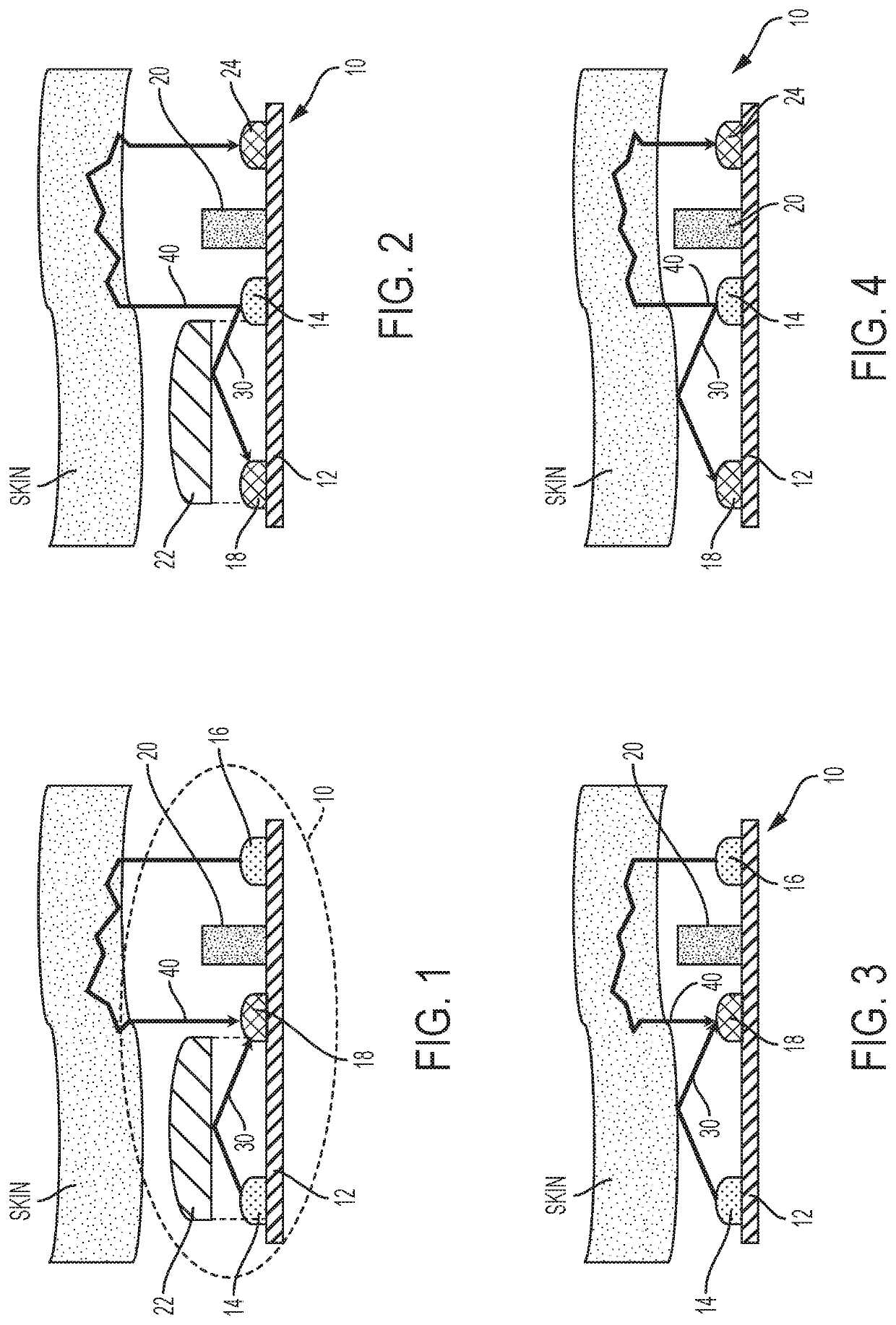 Methods and apparatus for detecting motion via optomechanics