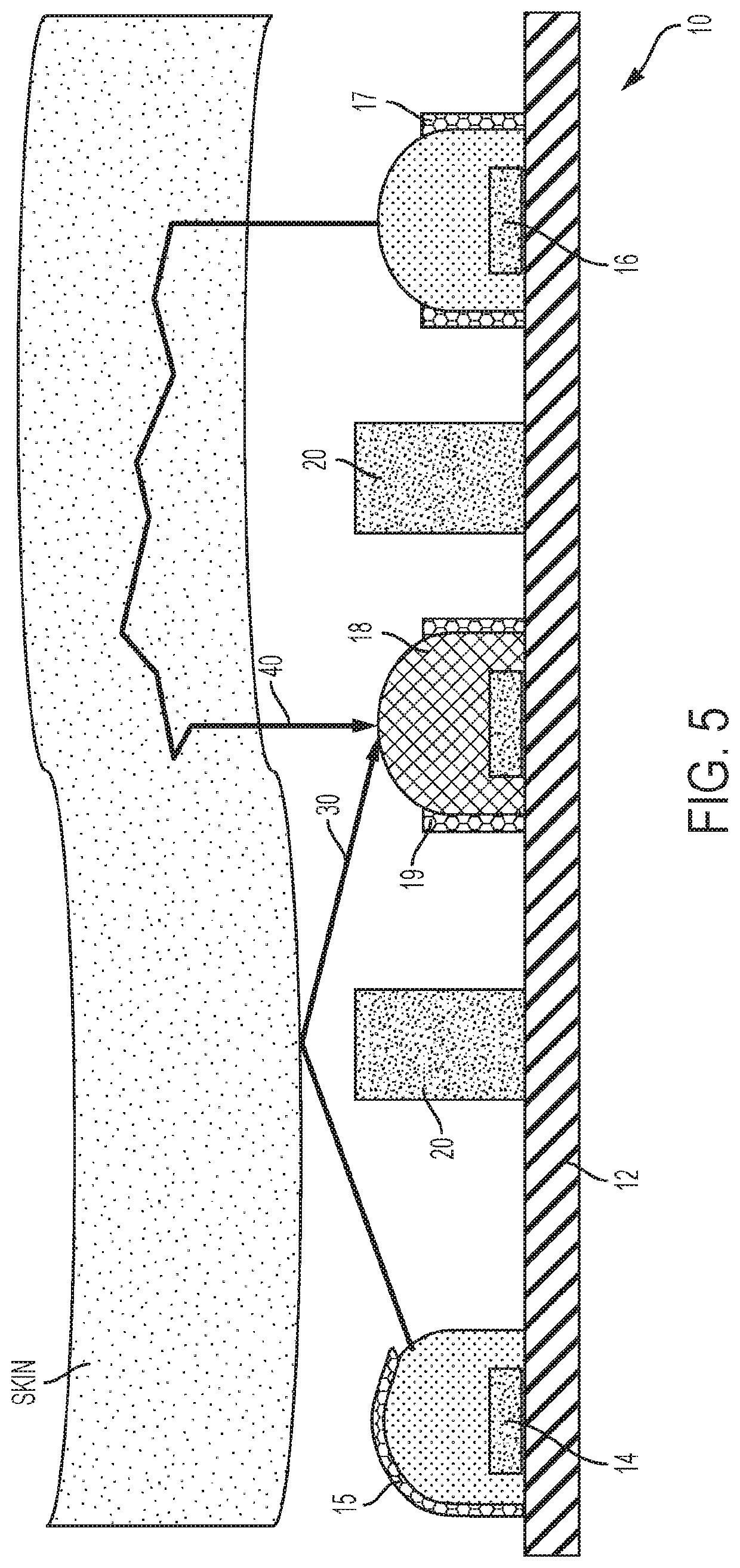 Methods and apparatus for detecting motion via optomechanics