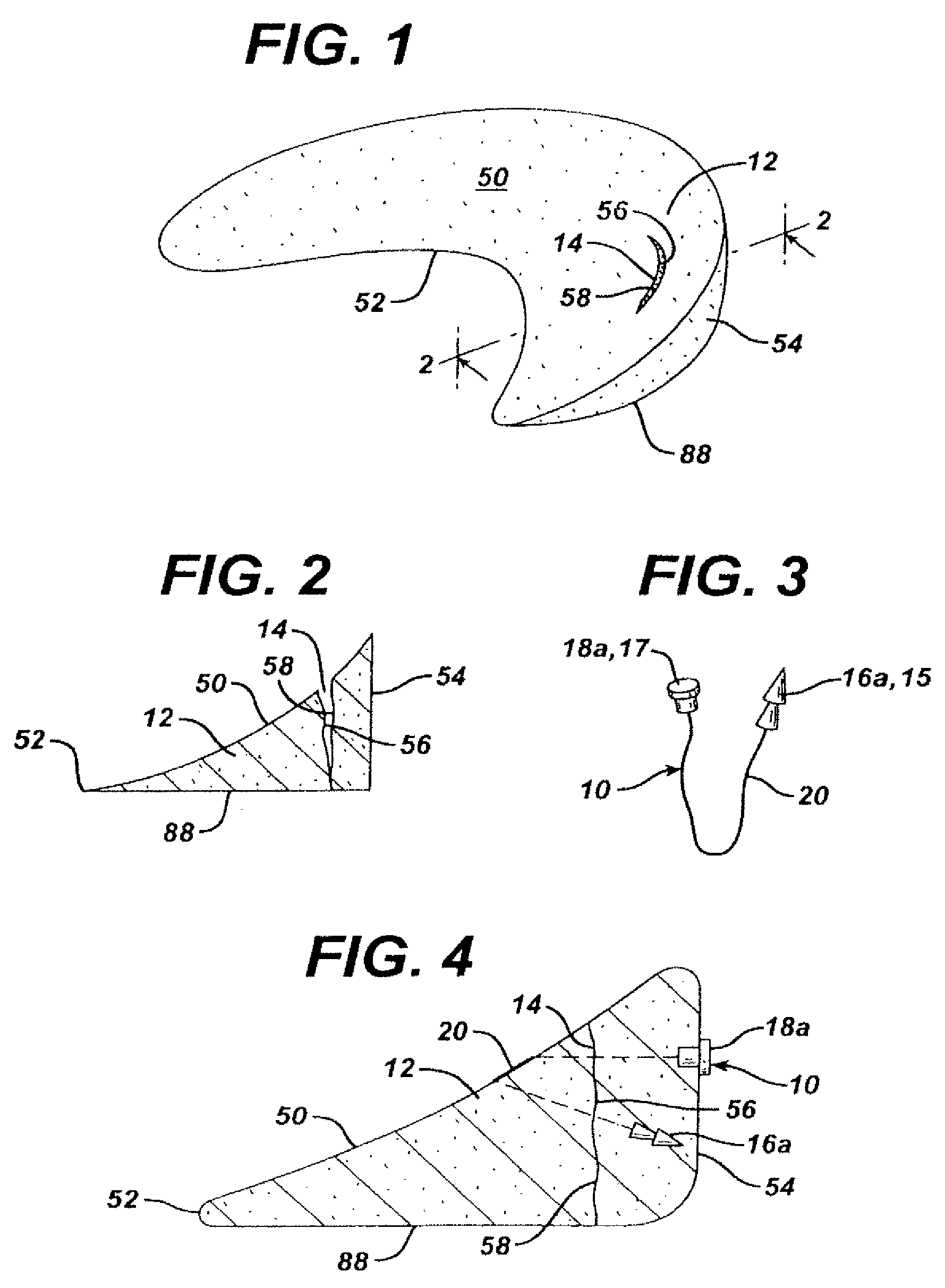 Unitary surgical device and method