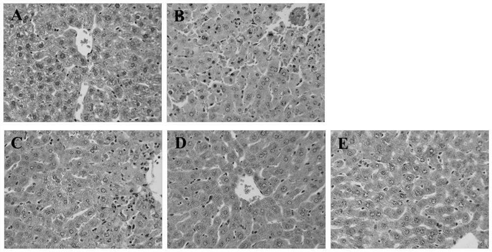 New application of rotigotine in preparation of acute liver injury resisting drug