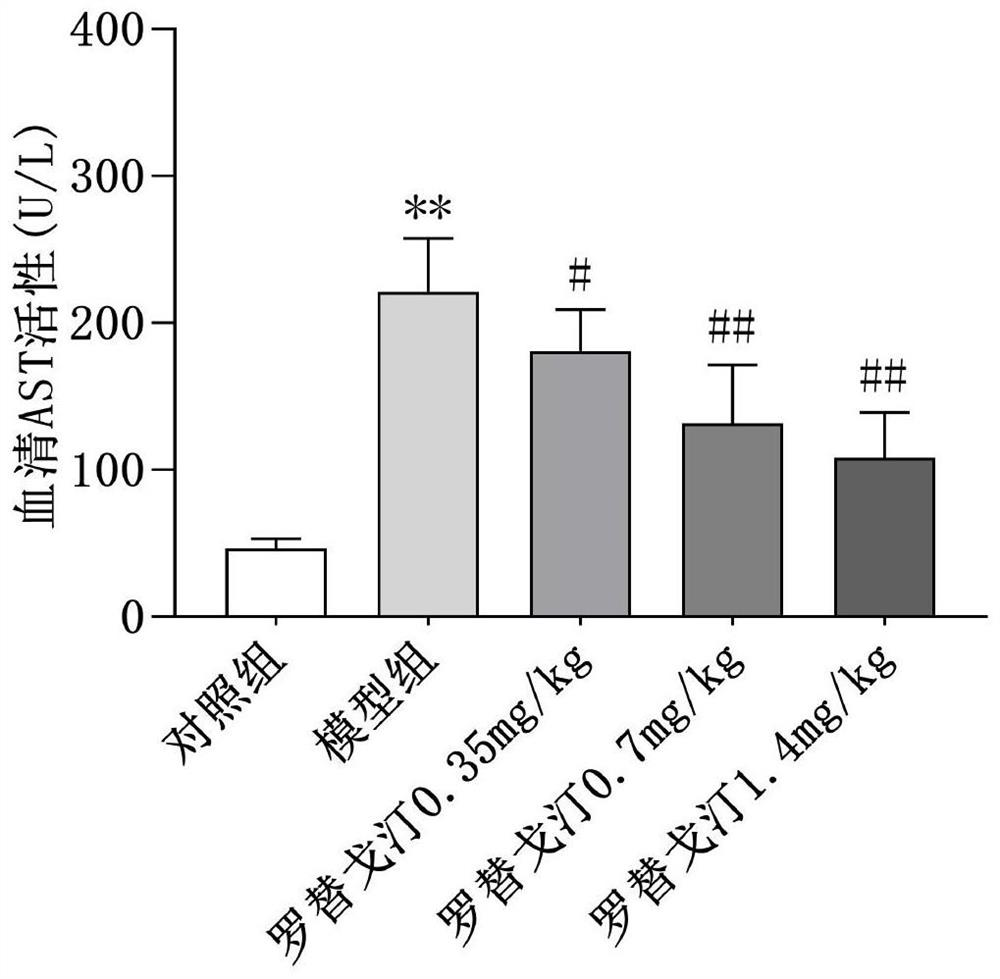 New application of rotigotine in preparation of acute liver injury resisting drug