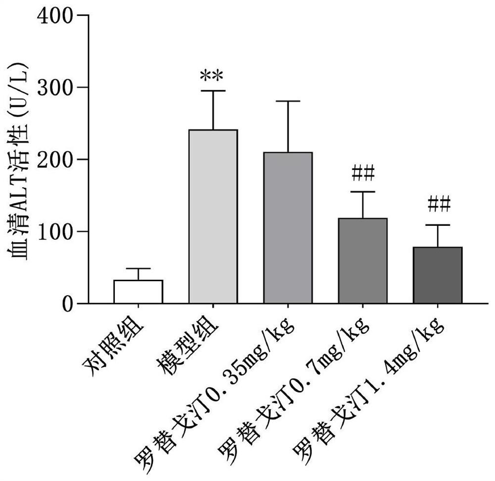 New application of rotigotine in preparation of acute liver injury resisting drug