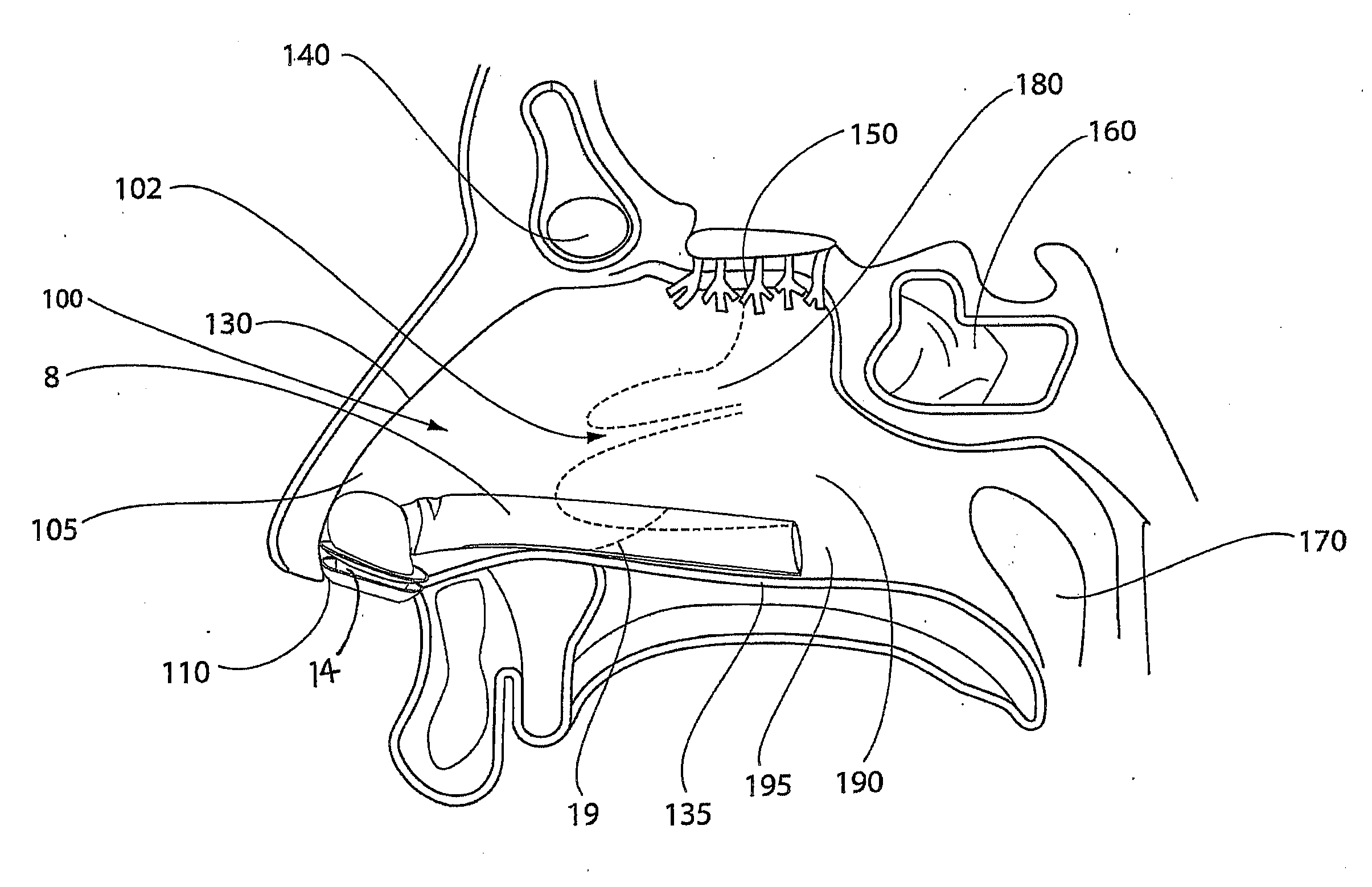 Nostril Inserts