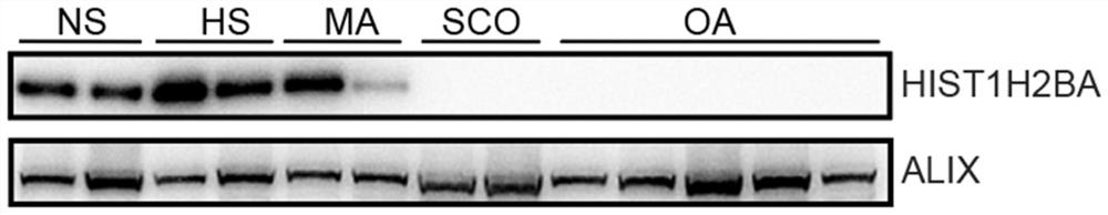 Application of seminal plasma extracellular vesicle HIST1H2BA protein