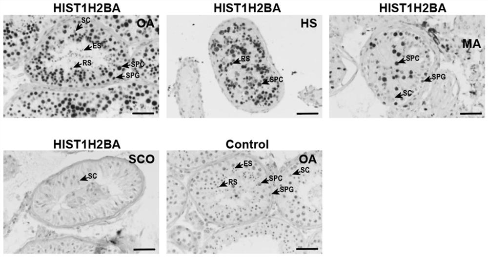 Application of seminal plasma extracellular vesicle HIST1H2BA protein