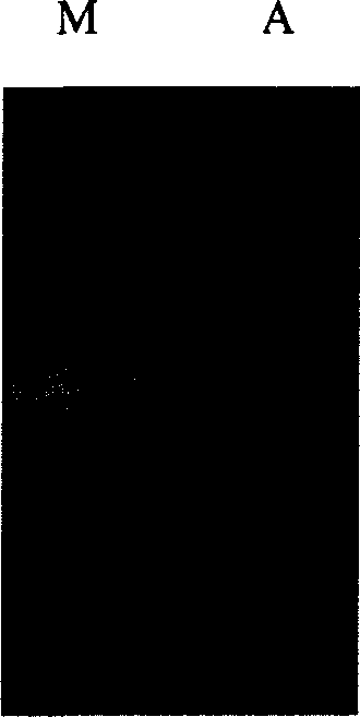 Gene for coding, 1,3-propylene glycol reductase in E.aero strain