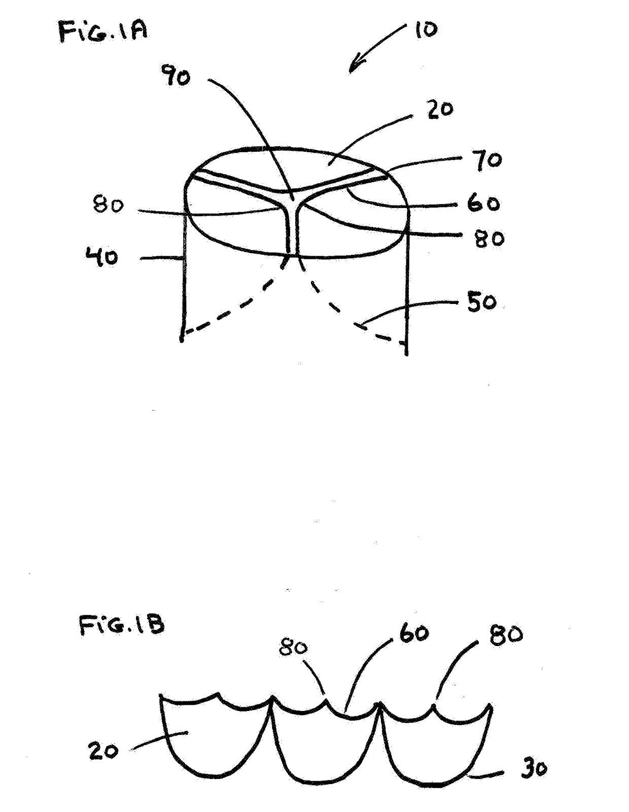 Free Edge Supported Mitral Valve