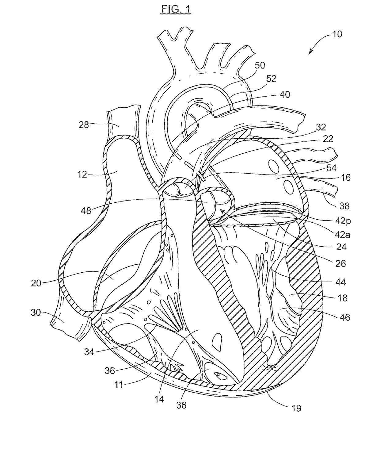 Cardiac mapping and navigation for transcatheter procedures