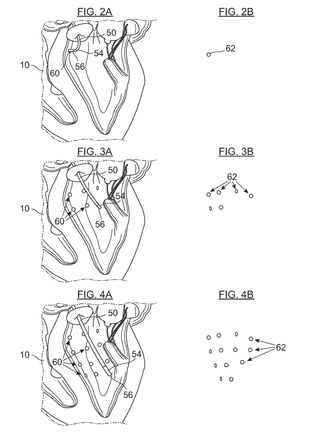 Cardiac mapping and navigation for transcatheter procedures