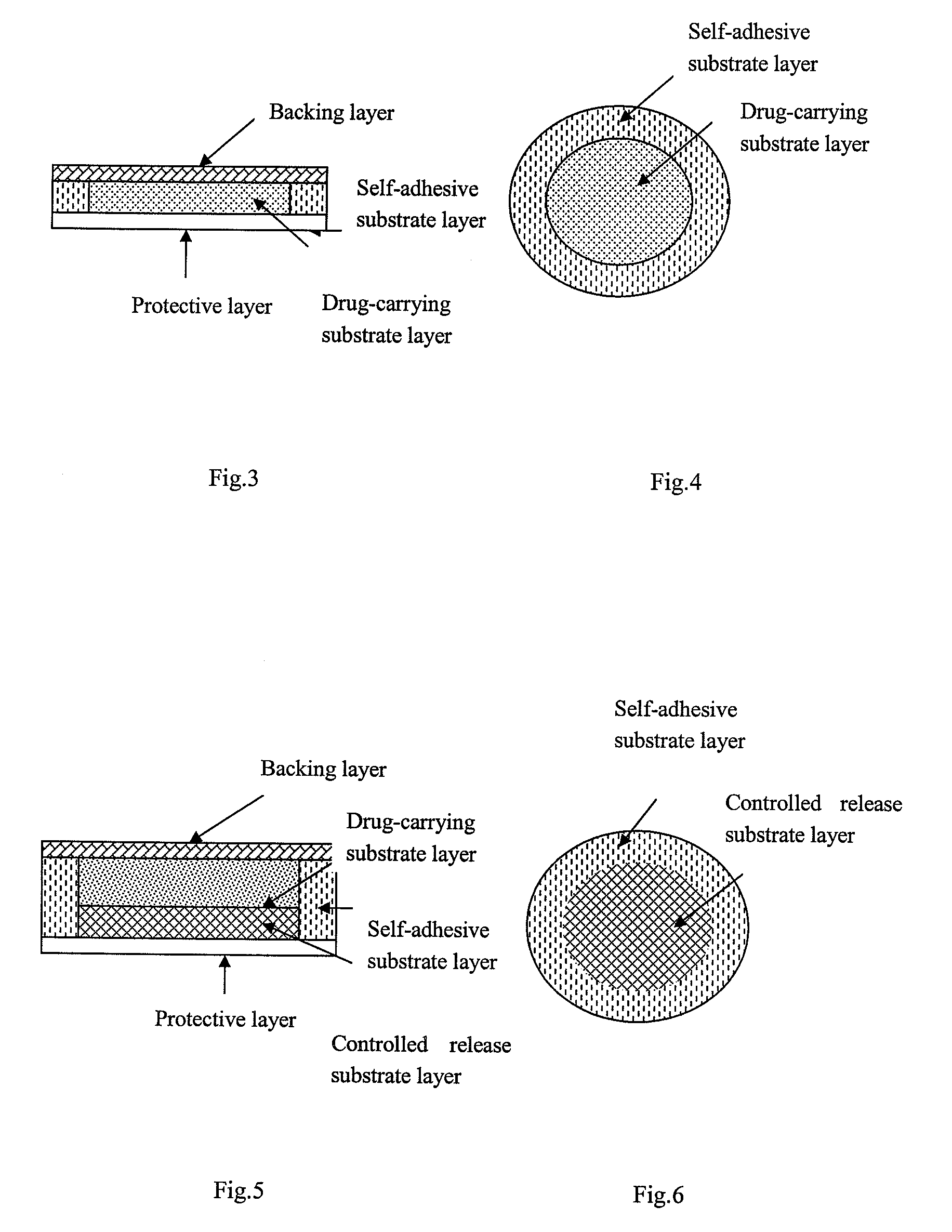 Transdermal patch containing rasagiline for treatment or prophylaxis of nervous system disease and its preparation process