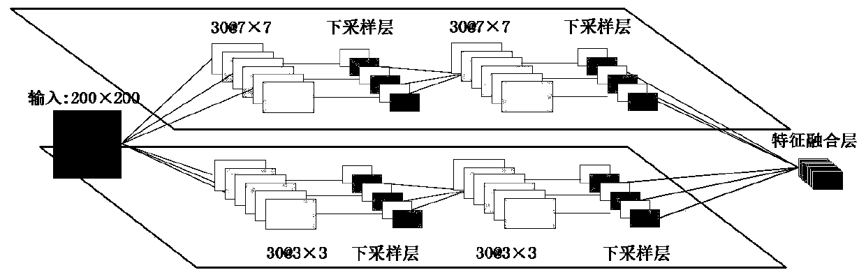 X-ray mammary gland image deep learning classification method