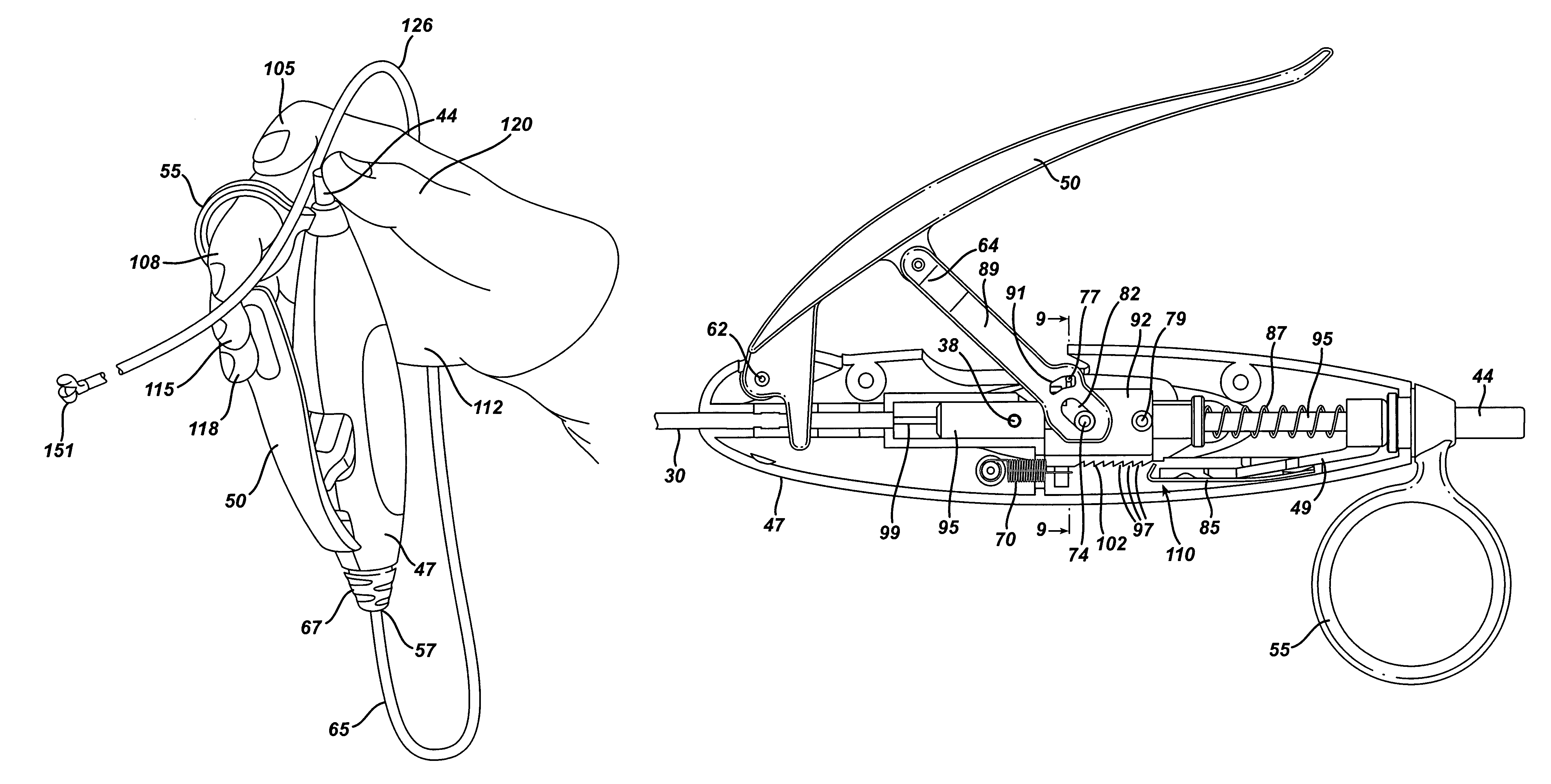 Actuation mechanism for flexible endoscopic device