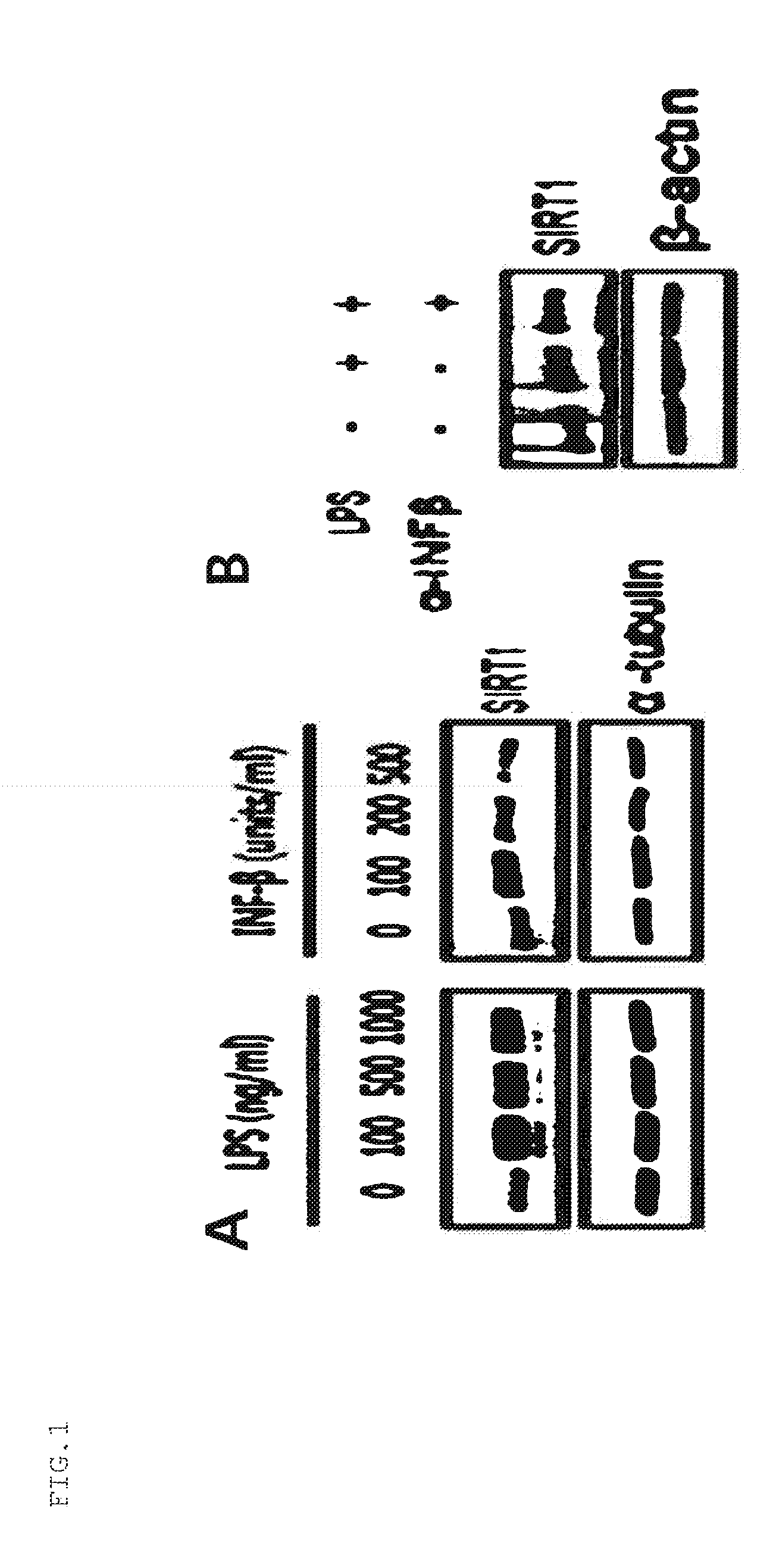 Composition containing inducer of sirt1 expression for preventing or treating sepsis or septic shock