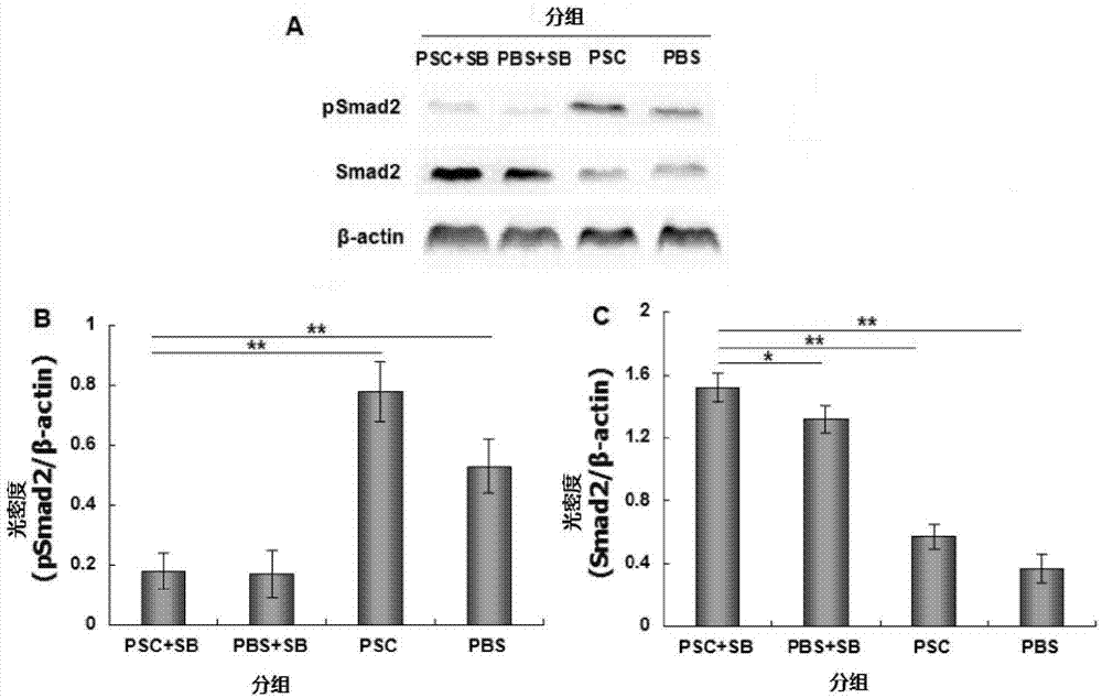 Use of TGF-beta 1 receptor blocker in preparation of drugs for preventing echinococcosis recurrence