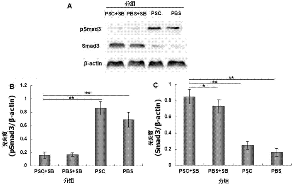 Use of TGF-beta 1 receptor blocker in preparation of drugs for preventing echinococcosis recurrence