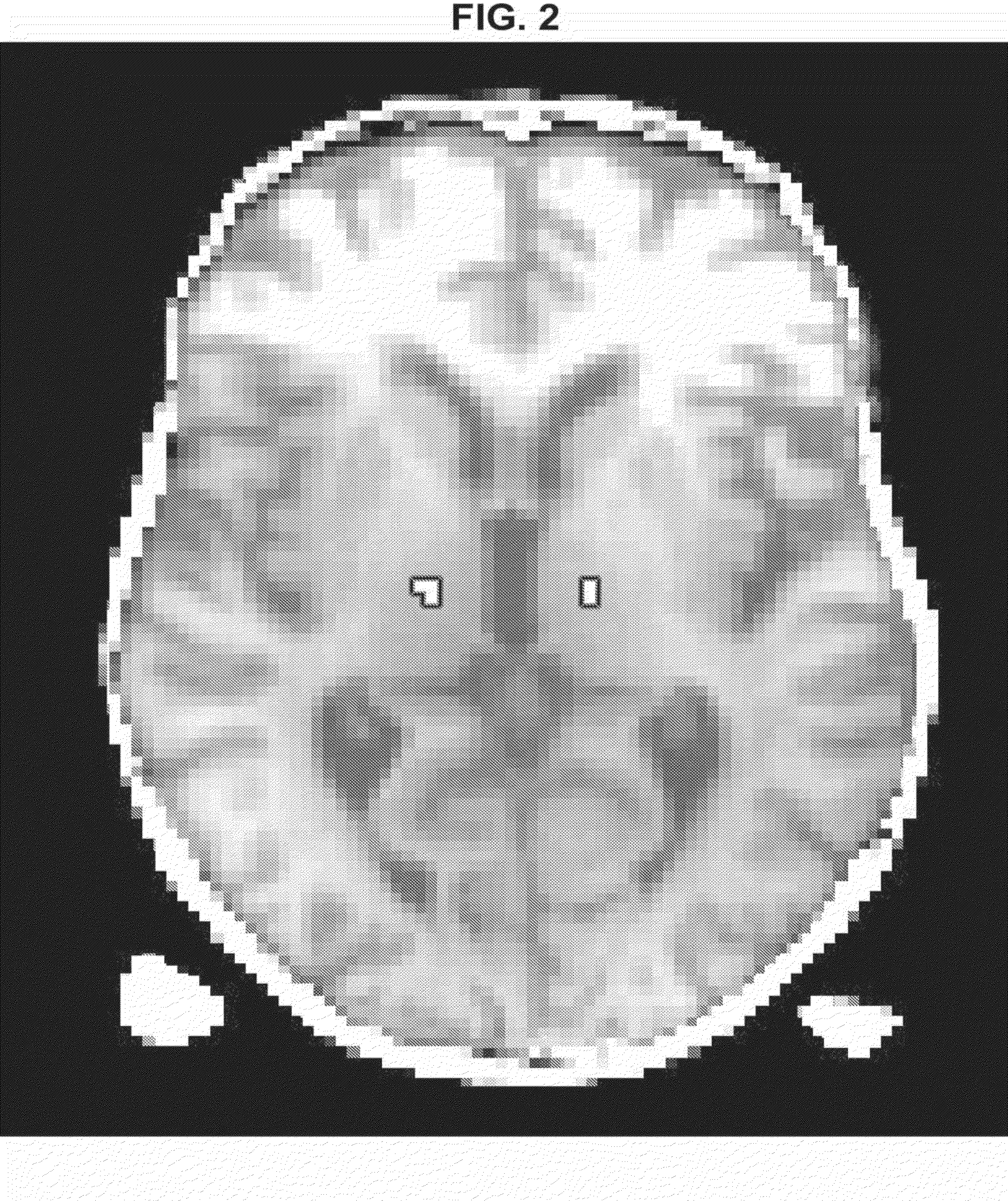 Method for deep brain stimulation targeting based on brain connectivity