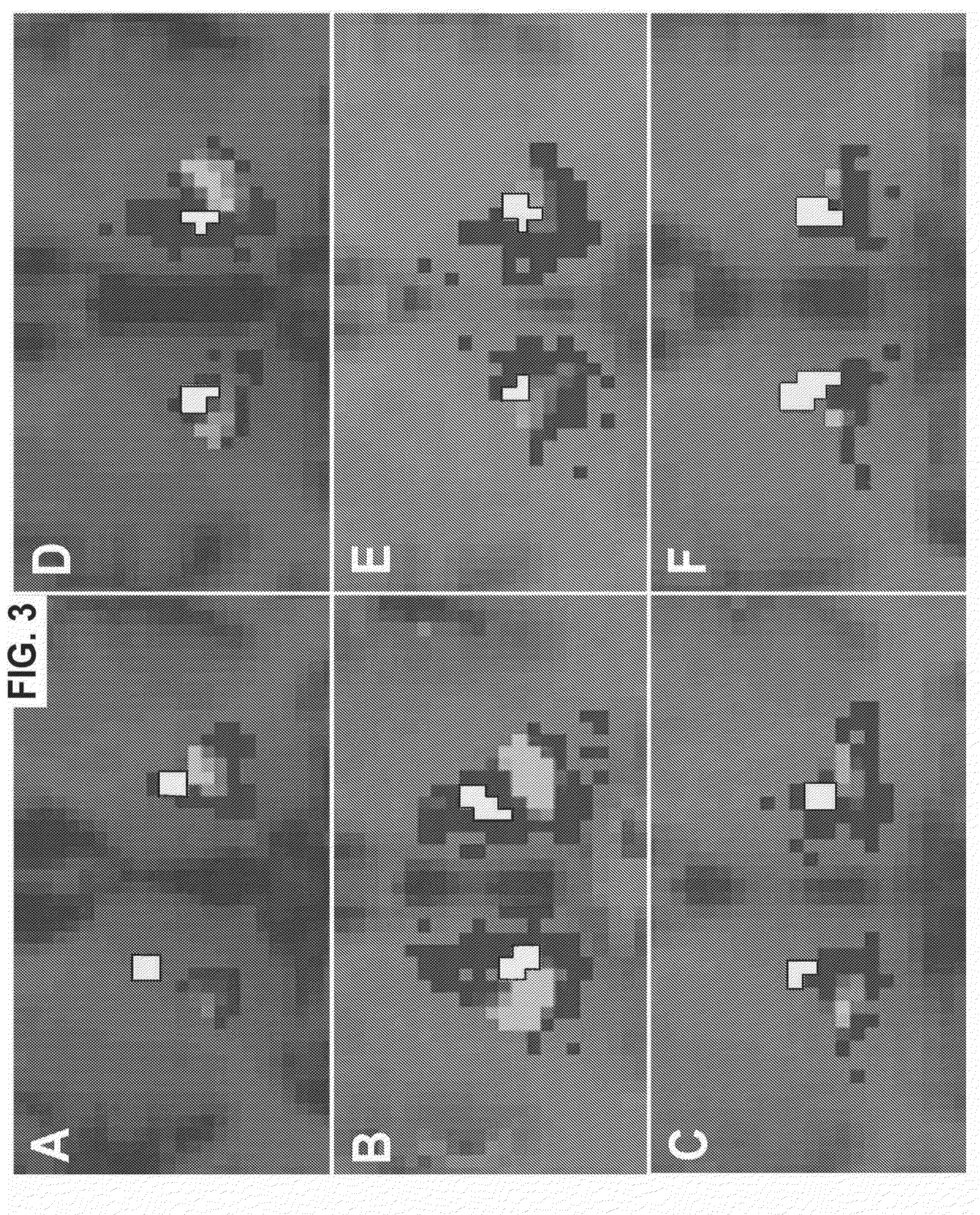 Method for deep brain stimulation targeting based on brain connectivity