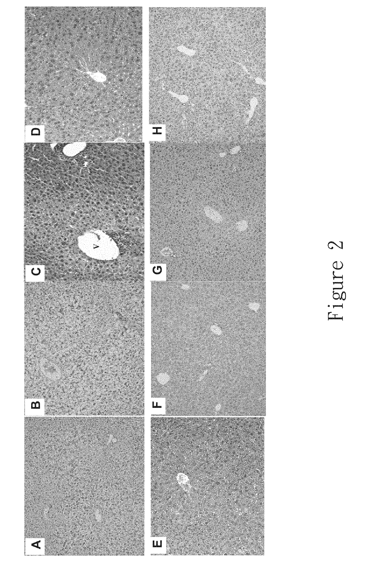 Hepatotoxicity-free pharmaceutical composition containing acetaminophen drugs