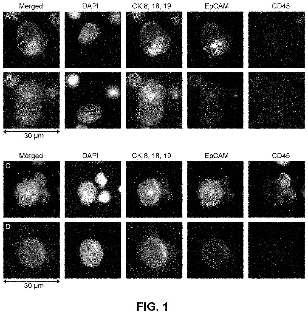 Capture, identification and use of a new biomarker of solid tumors in body fluids