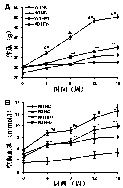 Functions and use of zinc finger protein A20 in treating fatty liver and type 2 diabetes mellitus