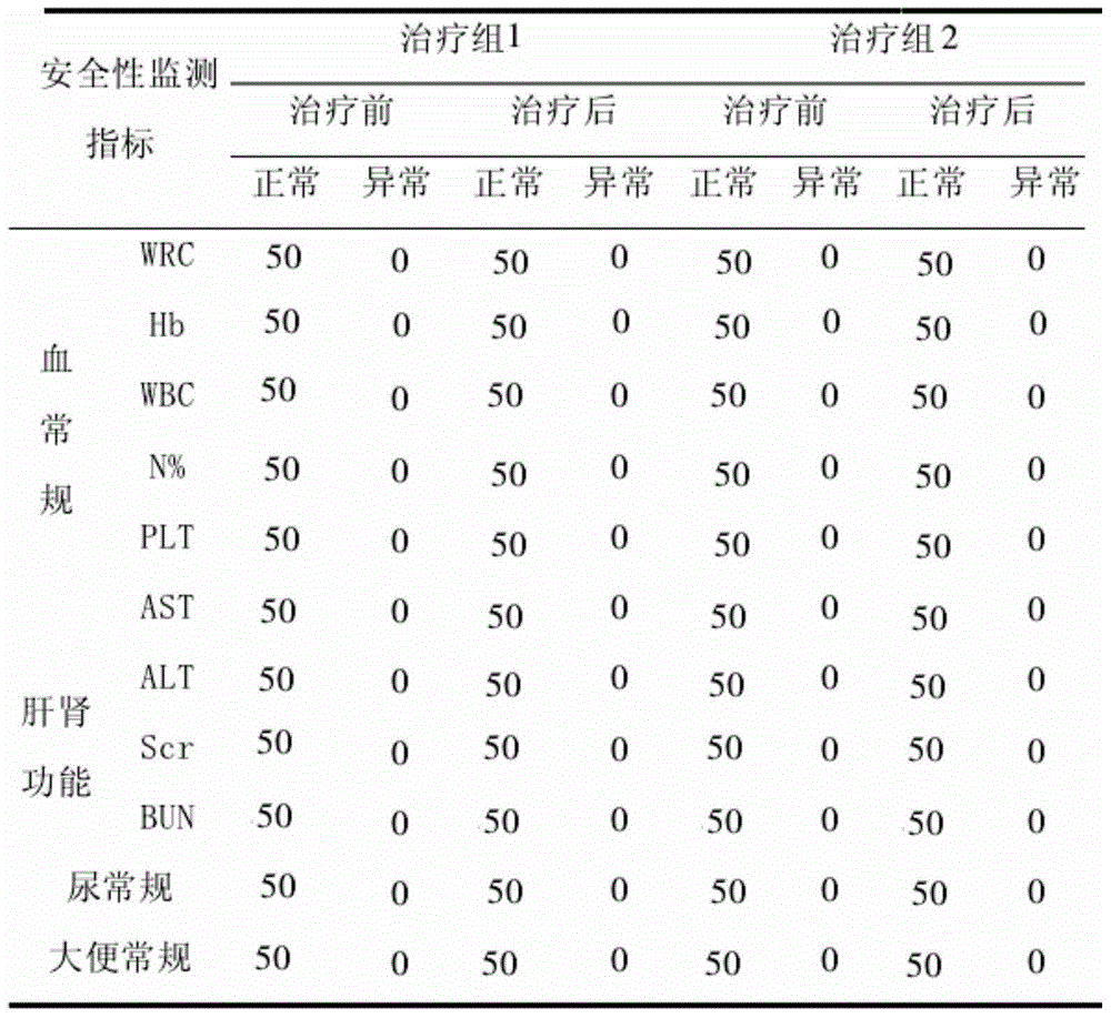 Traditional Chinese medicine composition for treating rhinitis