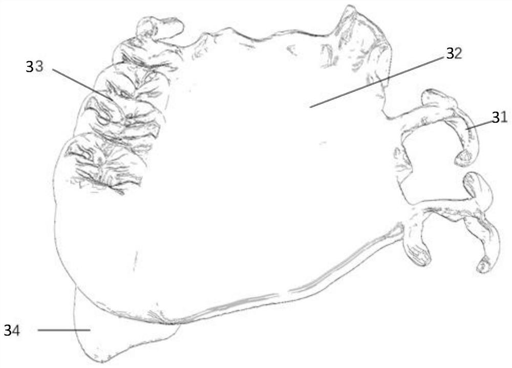 A method and system for making a prosthesis for a maxillary defect