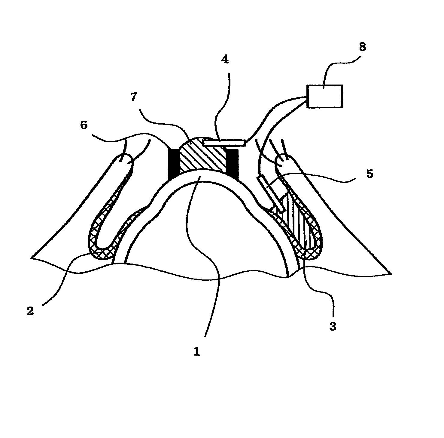 Method of measuring electrical resistance value of corneal trans-epithelium