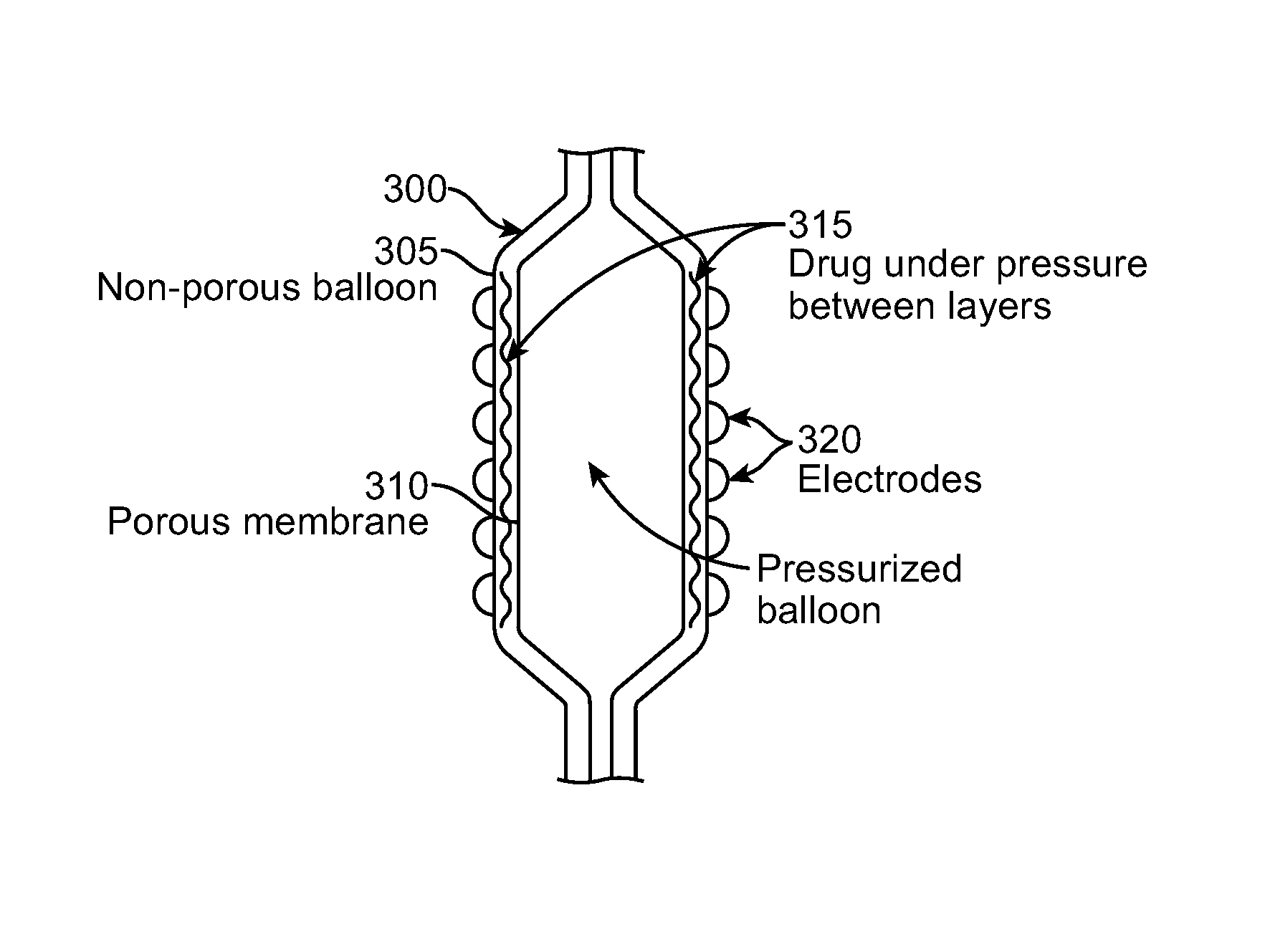 Selective drug delivery in a lumen