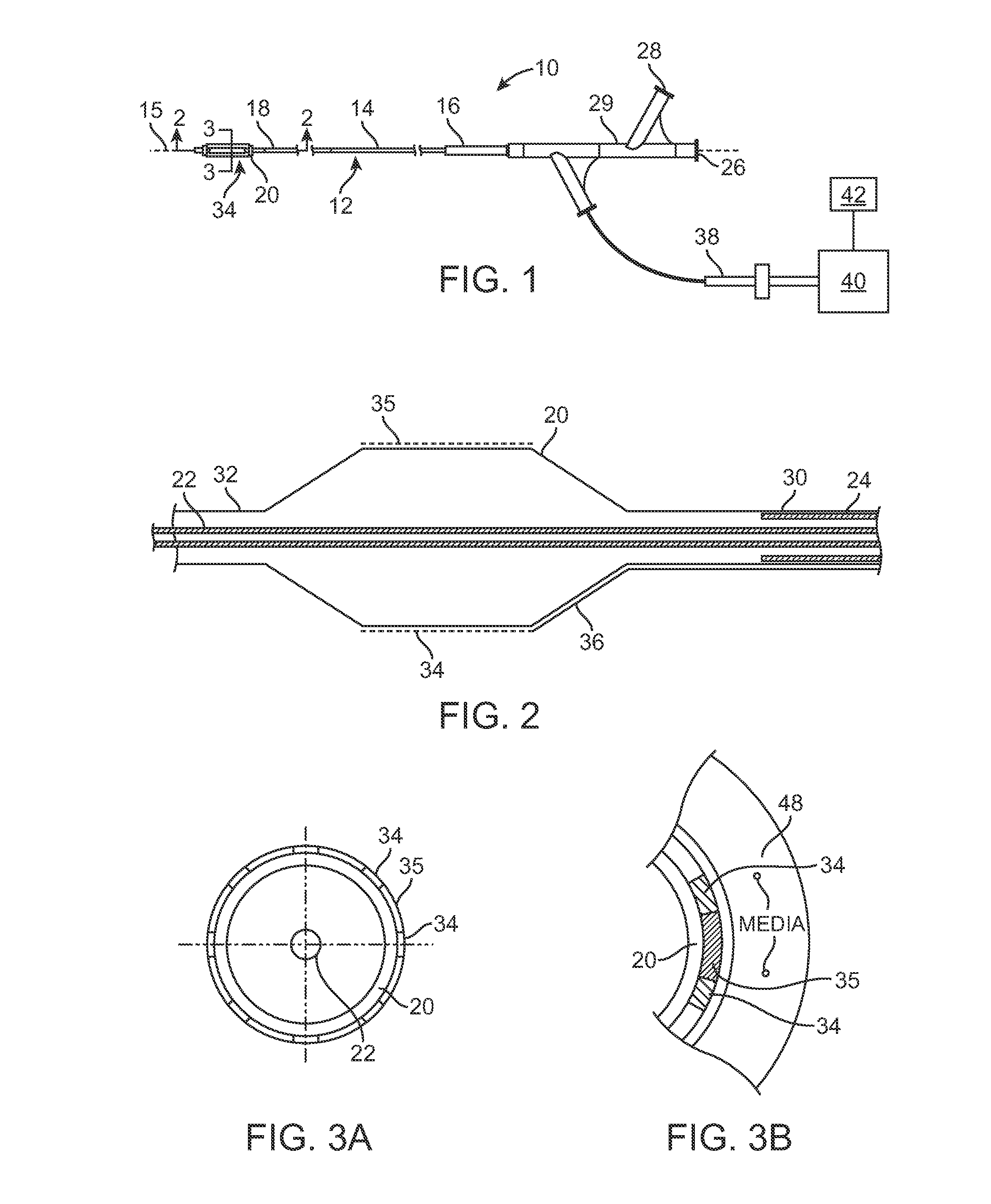 Selective drug delivery in a lumen