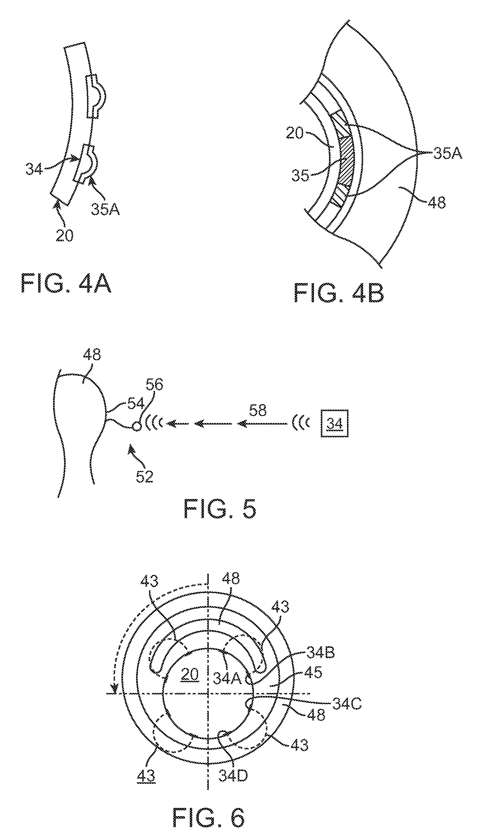 Selective drug delivery in a lumen