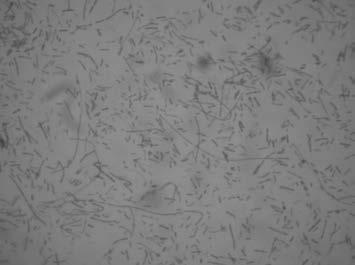 Haemophilus parasuis, streptococcus suis and actinobacillus pleuropneumoniae triple inactivated vaccine and application thereof