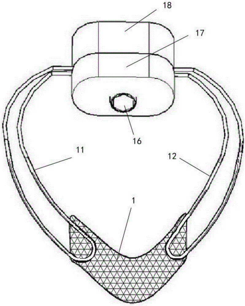 Adjustable suspender for uracratia