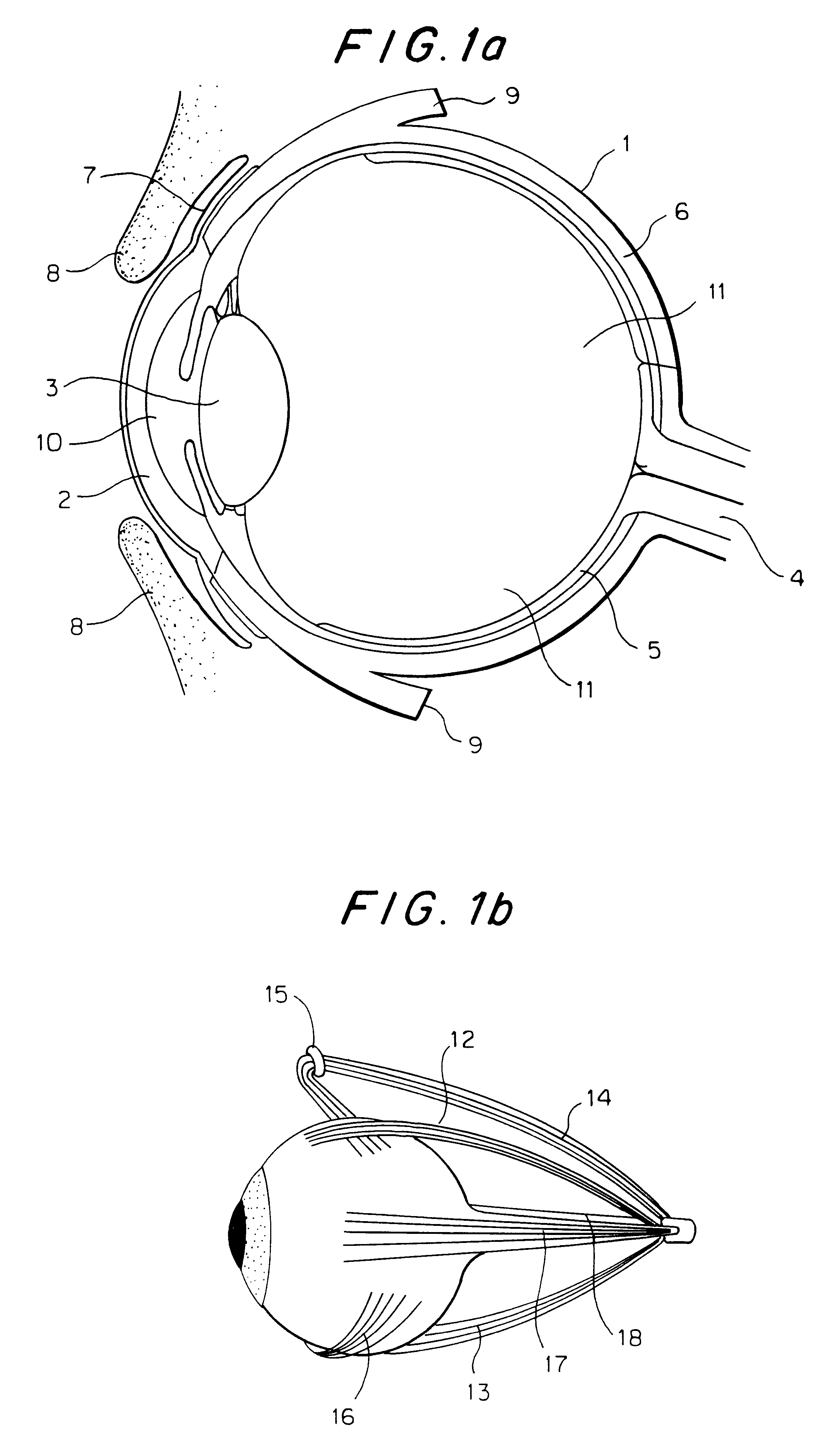 Ocular socket prosthesis